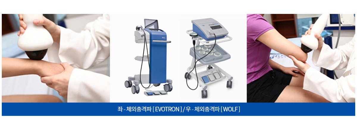 체외충격파(EVOTRON)와 체외충격파(WOLF) 기기와 시술을 받고 있는 환자들의 모습