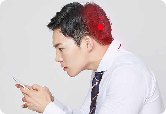 후두신경통의 원인 민감한 뇌에 유발인자가 시상하부 기능이상을 유발하여 뇌혈관이 확장되어 후두신경통을 유발함