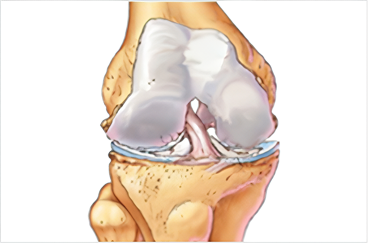 건강한 무릎연골
