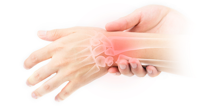 삼각섬유연골 파열