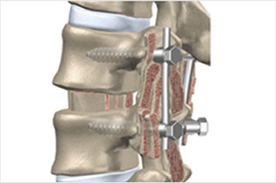 고령 및 심혈관계질환으로 전신마취와 수술 위험도가 높은 환자의 시술 사례