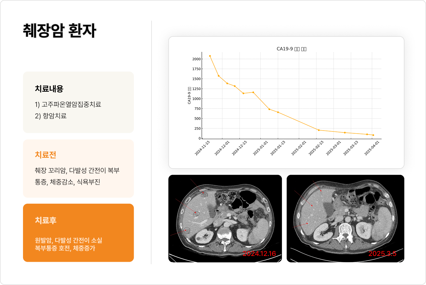 췌장암 환자 전후 결과 2
