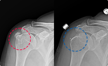 염증 오아시스 케어