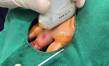 실시간 초음파의 정밀함