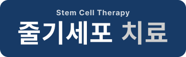 줄기세포 치료