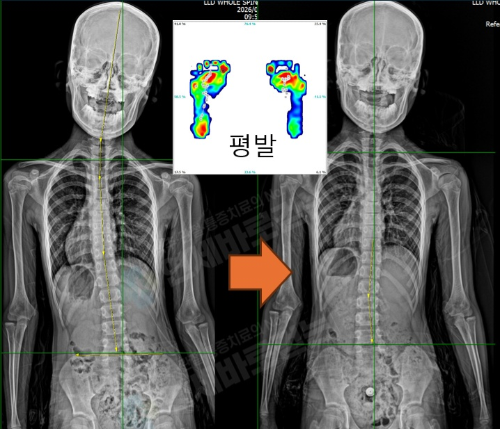 사례 3