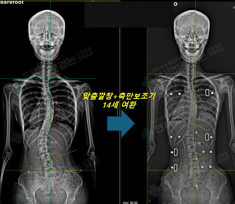 사례 4